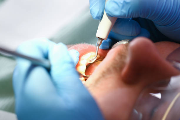 Best Same-Day Emergency Dentist in Rancho Santa Margarita, CA