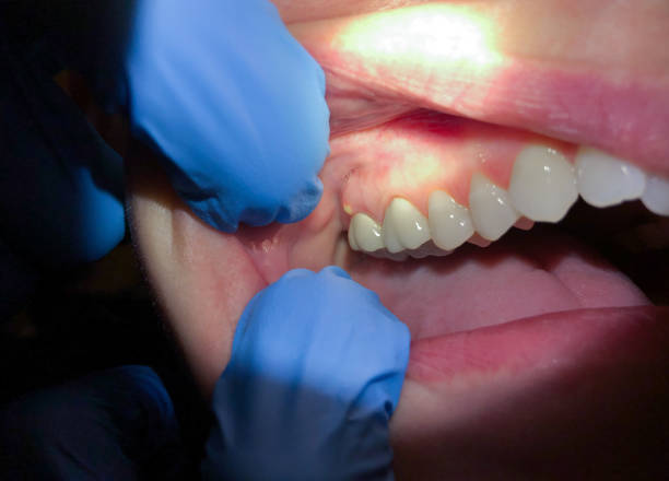 Best Emergency Dental Care for Trauma or Injury in Rancho Santa Margarita, CA